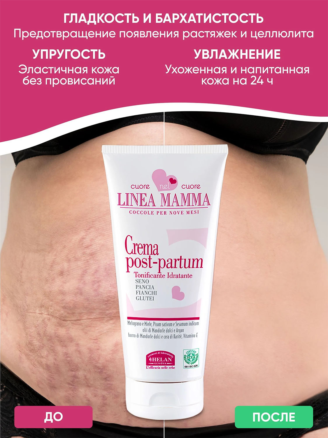 Крем HELAN Linea Mamma для восстановления фигуры после родов 150 мл